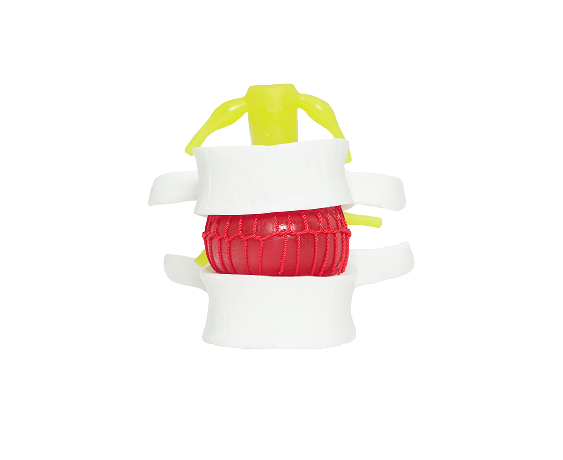 MODELL BANDSCHEIBENVORFALL